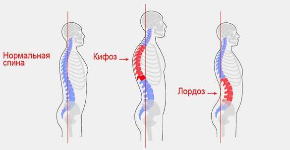 Таблица упражнений для укрепления спины: