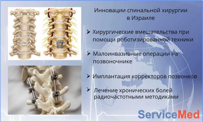 Методы стабилизации позвоночника — эффективные способы для здоровой спины
